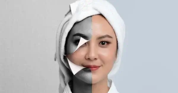 चेहरे पर काले धब्बे के कारण क्या है?